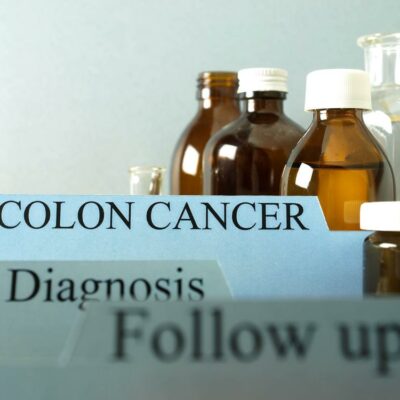 Alternative treatments for colon cancer