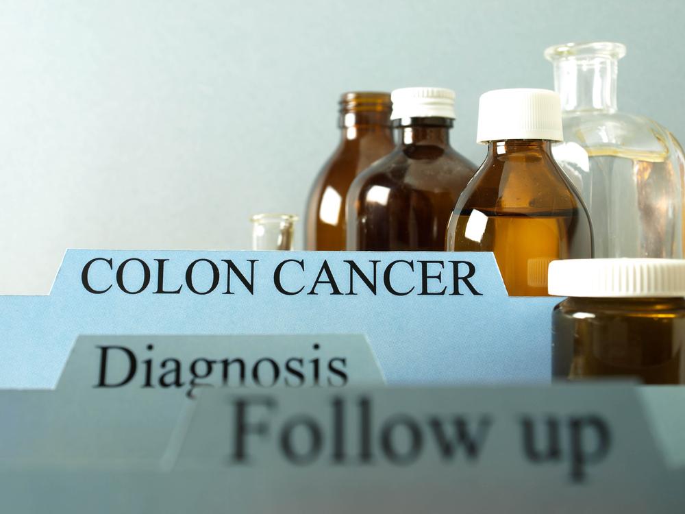 Alternative treatments for colon cancer