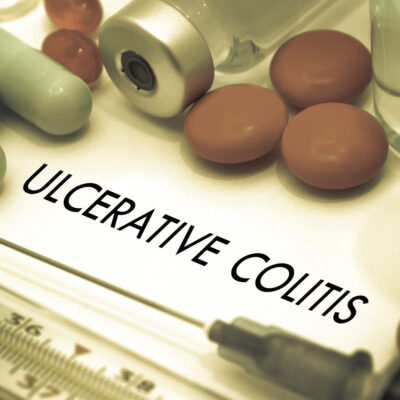 Foods to Eat and Avoid with Ulcerative Colitis