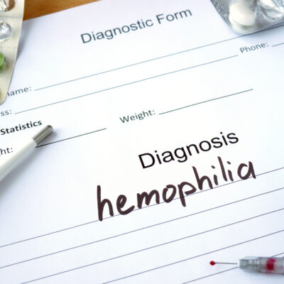 Types of treatment options for hemophilia