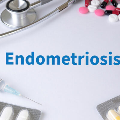 5 Early Signs of Endometriosis